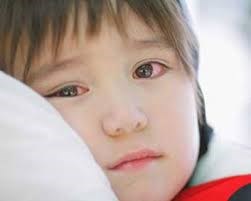 Cảnh giác với những dấu hiệu lạ ở mắt trẻ